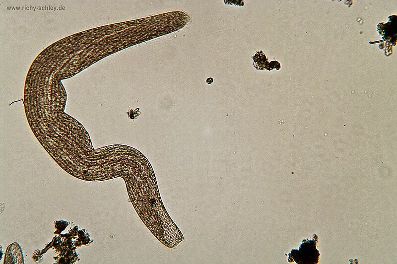 File:Nematoda Fadenwurm.jpg